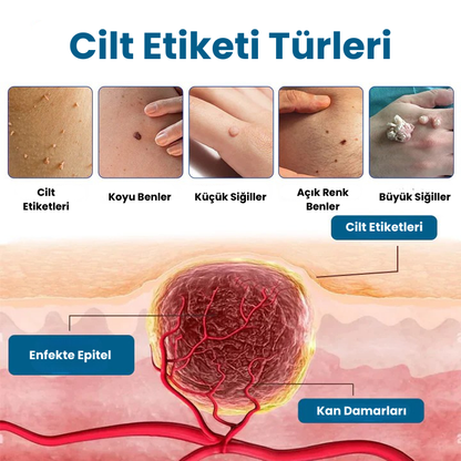 Timilk® DermaVenom RX+ Hassas Bölgesel Giderici Sprey