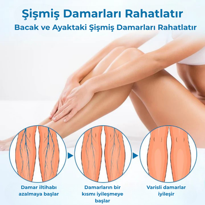 Timilk® VeinGuard Bitkisel Sprey – Sadece 14 günde varisleri ortadan kaldırdığı klinik olarak kanıtlanmıştır!